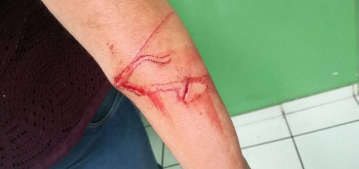 Niño de 10 años ataca con su cuchillo a su maestra